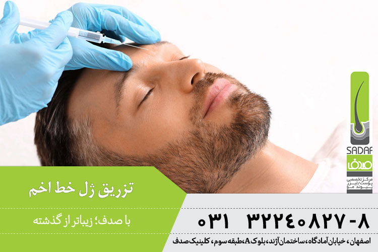 فیلر خط اخم 