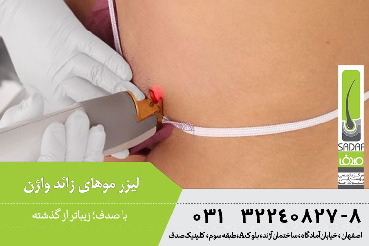لیزر موهای زائد بیکینی در اصفهان