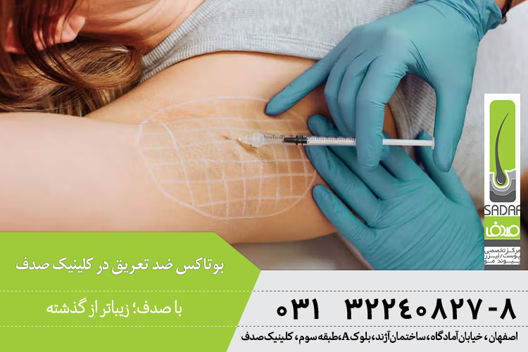 بوتاکس تعریق چیست؟
