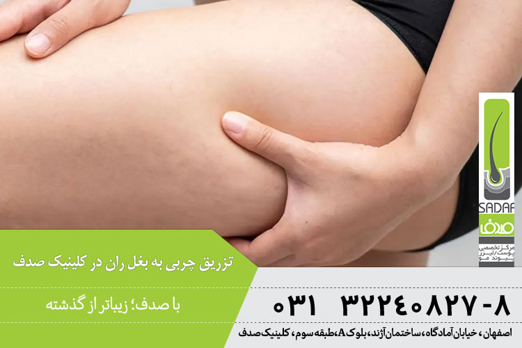 کاربرد تزریق چربی به هیپ دیپ