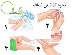 درمان قطعی فیشر؛آنال فیشر؛دکتر خانم فیشر؛فیشر حاد؛هزینه درمان شقاق؛فیشر در بچه ها؛فیشر مزمن؛بهترین دکتر فیشر؛عمل فیشر؛بهترین دکتر فیشر؛بهترین درمان فیشر؛هزینه درمان فیشر؛جراحی فیشر؛عمل جراحی فیشر؛فیشر؛تشخیص فیشر ؛فیشر مقعد؛پماد شقاق؛دکتر خانم شقاق ؛شقاق؛عمل جراحی شقاق؛عمل شقاق؛شقاق مقعد؛تشخیص شقاق؛شقاق چیست؛لیزر شقاق؛شقاق حاد؛شقاق مزمن؛انواع شقاق؛بهترین درمان شقاق؛درمان قطعی شقاق؛درمان شقاق؛علائم شقاق