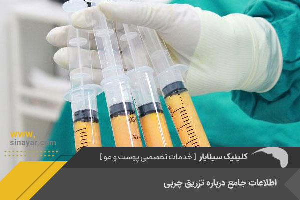 تزریق چربی در اصفهان