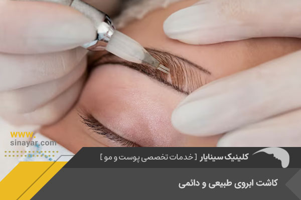 کاشت ابروی طبیعی در اصفهان