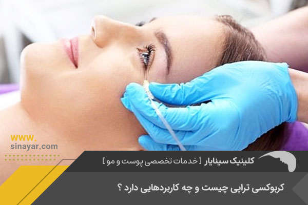 بهترین کربوکسی تراپی صورت در اصفهان