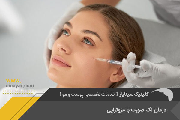 درمان لک صورت با مزوتراپی در اصفهان
