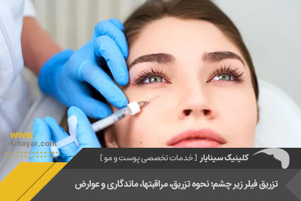 تزریق فیلر زیر چشم