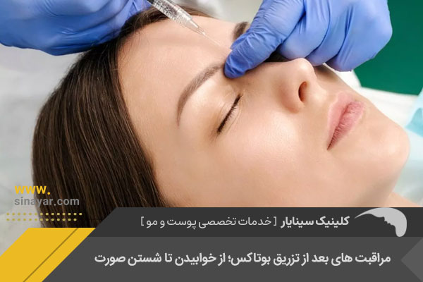مراقبت بعد از بوتاکس
