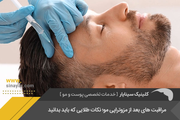 مراقبت های بعد از مزوتراپی مو