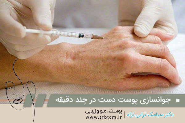 عکس تزریق ژل دست
