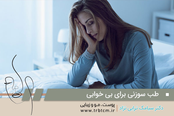 طب سوزنی برای بی خوابی