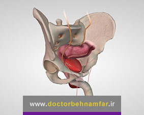 بعد از عمل پروستات، اختلال نعوظ پیدا می کنید؟