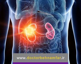 با نشانه های خاموش سرطان کلیه آشنا شوید