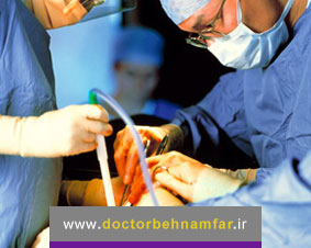 جراحی برداشتن پروستات چه عوارضی دارد؟