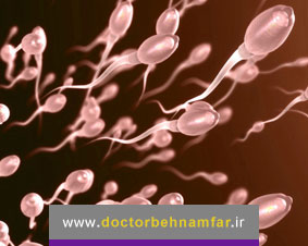 افزایش کیفیت اسپرم در اختلالات اسپرموگرام