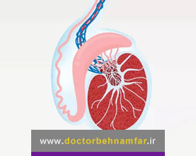 واریس بیضه چیست و آیا واریس بیضه باعث ناباروری می شود؟