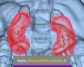 علل علائم و درمان سندرم نفروتیک