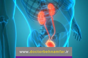 ریفلاکس ادراری یا برگشت ادرار چیست چه علائمی دارد و چگونه درمان میشود؟