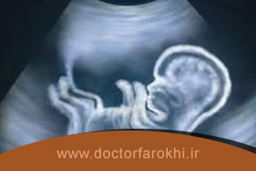 چرا انجام سونوگرافی در بارداری ضروری است؟