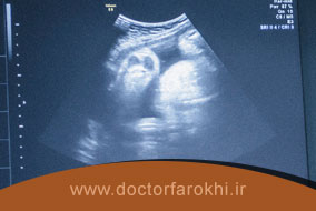 آیا با سونوگرافی ناهنجاری‌های جنین تشخیص داده و بررسی میشود؟