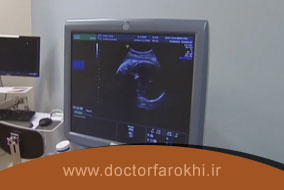 سونوگرافی بقایای بعد از سقط جنین