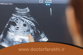 تشخیص ناهنجاری های کروموزومی جنین با سونوگرافی