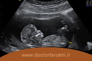 تفاوت سونوگرافی و اولتراسونوگرافی
