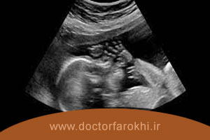 تفسیر سونوگرافی بارداری و جنین