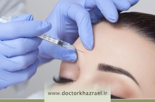 ماندگاری مزوبوتاکس و مدت اثربخشی آن روی پوست