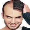 ارزیابی عمل کاشت موی طبیعی