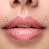 جراحی لیفت لب