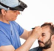 اهمیت خط مو و طراحی آن در کاشت موی طبیعی