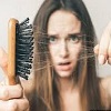 چگونه از ریزش موی غیر ارثی جلوگیری کنیم