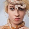 بیماری گزرودرما پیگمنتوزوم