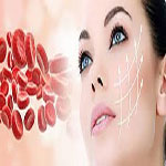 به تنهایی وهمراه تزریق چربی (پی آر پی ) PRP
