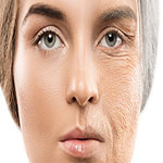 پیری پوست چیست ؟