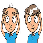 همه چیز درباره کاشت مو - قسمت دوم