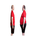 ليپوماتيک و پيکرتراشى در چاقی