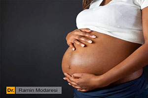 درمان ترک و خطوط بعد از حاملگی