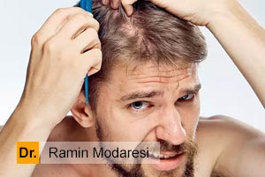 ریزش سکه ای ریش و موی سر چه علل و درمانی دارد؟