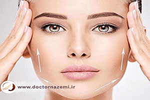 زاویه دار کردن صورت با تزریق ژل چگونه انجام می شود؟