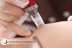 درماپن چه کاربردهایی برای پوست دارد؟