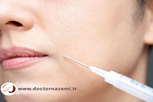عوارض احتمالی تزریق ژل در نواحی مختلف صورت و بدن