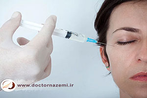 آیا ژل بعد از تزریق به صورت حرکت می کند؟