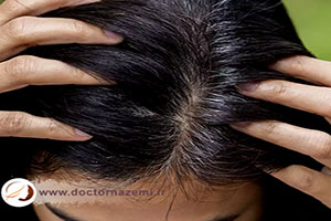 درمان سفیدی مو در سنین پایین