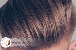تأثیر استفاده از روگین برای درمان ریزش مو