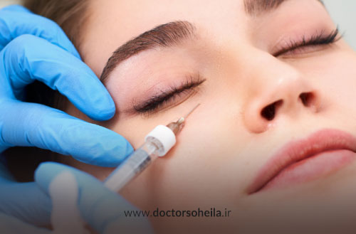 تزریق ژل زیر چشم؛ درمانی موثر برای تیرگی و گودی زیر چشم