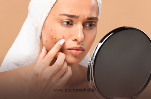 عوارض فیشیال صورت و روش های پیشگیری از آن