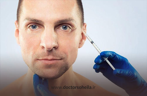 تزریق بوتاکس برای میگرن؛ درمانی موثر برای کاهش سردردهای مزمن