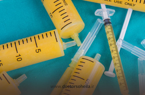 عوارض تزریق چربی به صورت؛ بررسی عوارض کوتاه مدت و بلندمدت