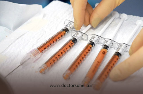 مراقبت های بعد از تزریق چربی به صورت؛ راهنمای کامل قبل و بعد از عمل